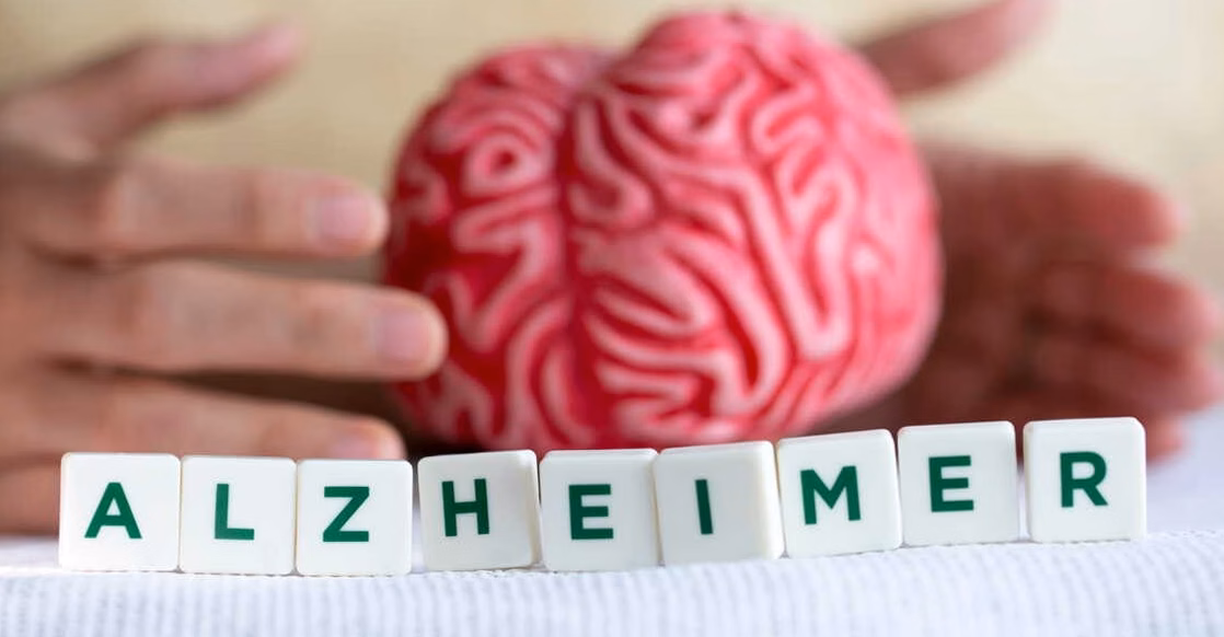 Vitamine D : une alliée potentielle dans la lutte contre Alzheimer ?
